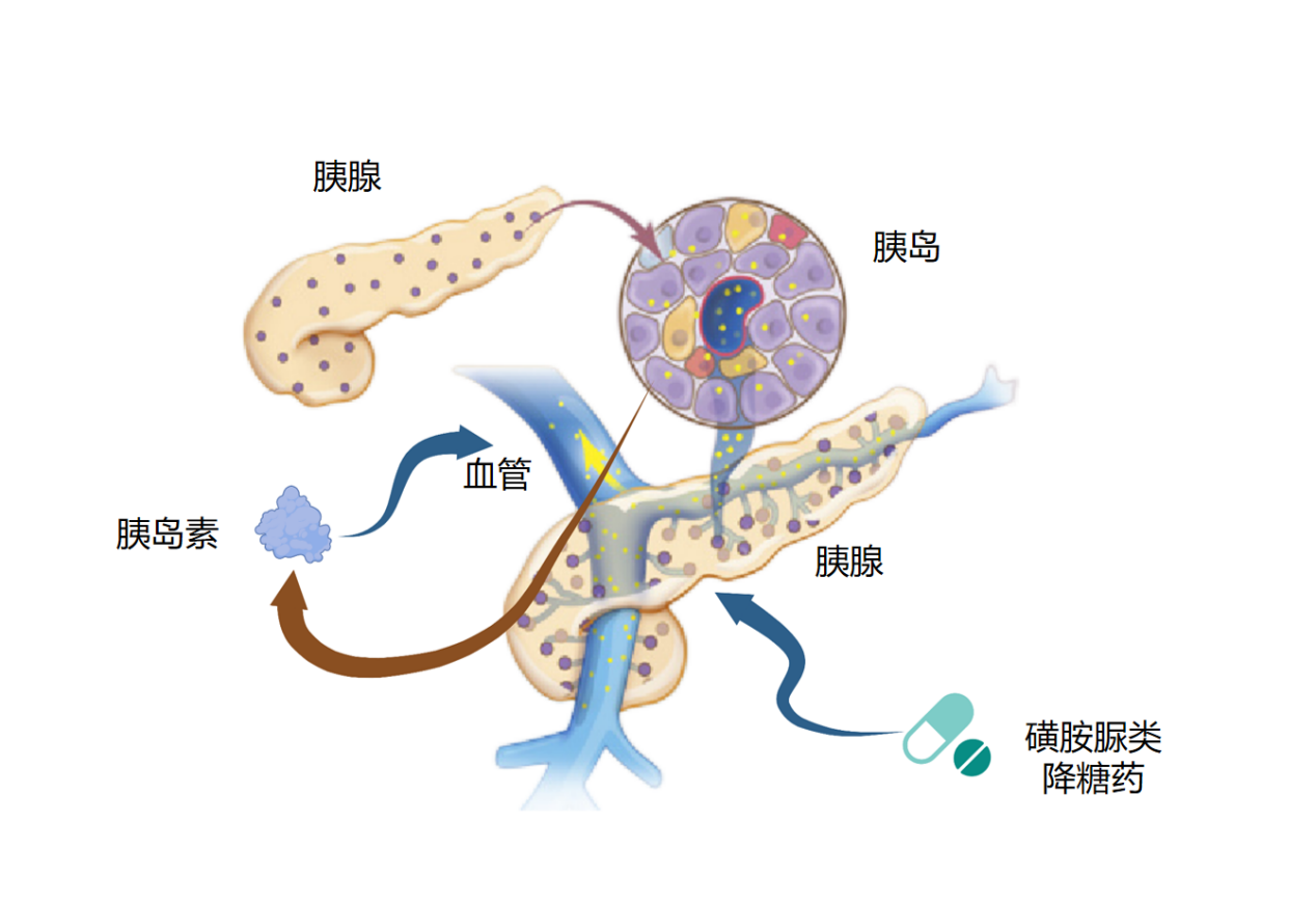 磺酰脲类降糖药用药小常识
